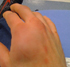 Bowles__broken_hand_70.jpg