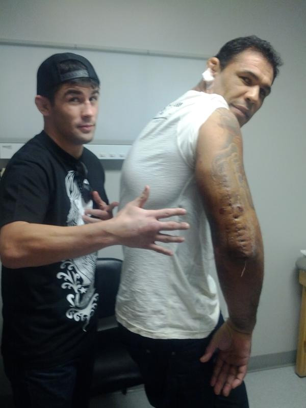 Big_Nog_scar.jpg
