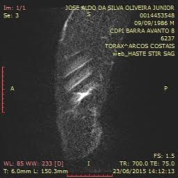 Aldo_x_ray_2.jpg